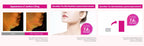 CKD Retino Collagen Gua Sha Neck Cream, 3.38 fl oz, 2-Pack