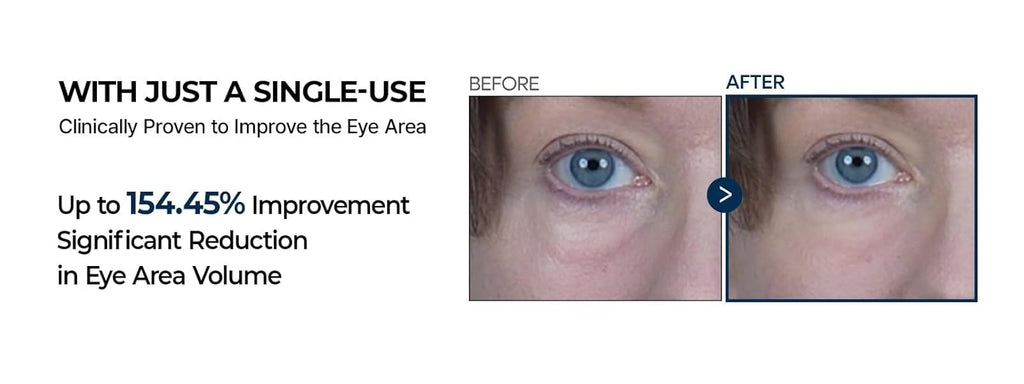Dr. Melaxin Eyephalt Eyebag Cream Duo | EGF + Bio-Spicule, Cerasome Complex, Arbutin + Glutathione | .35 oz x 2ea
