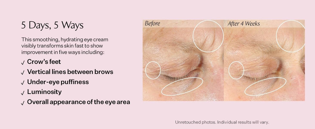 StriVectin Anti-Wrinkle Intensive Eye Cream Concentrate for Wrinkles Plus, Targets Crow's Feet, Firmness, Puffiness and Dark Circles | Paraben-Free, Suitable for All Skin Types | 1.25 Fl oz