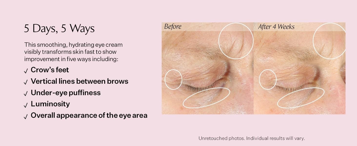 StriVectin Anti-Wrinkle Intensive Eye Cream Concentrate for Wrinkles Plus, Targets Crow's Feet, Firmness, Puffiness and Dark Circles | Paraben-Free, Suitable for All Skin Types | 1.25 Fl oz