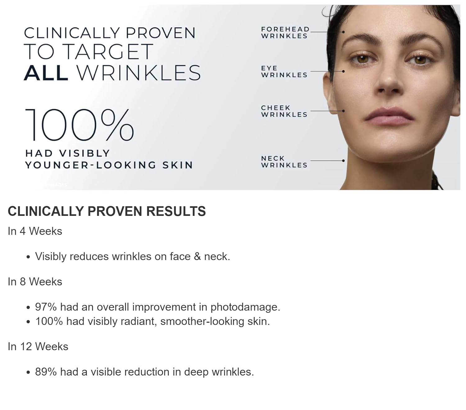Advertisement for skincare product showing clinical results on a woman's face with wrinkle locations labeled.