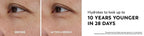 Before and after comparison of eye area with text claiming hydration benefits.