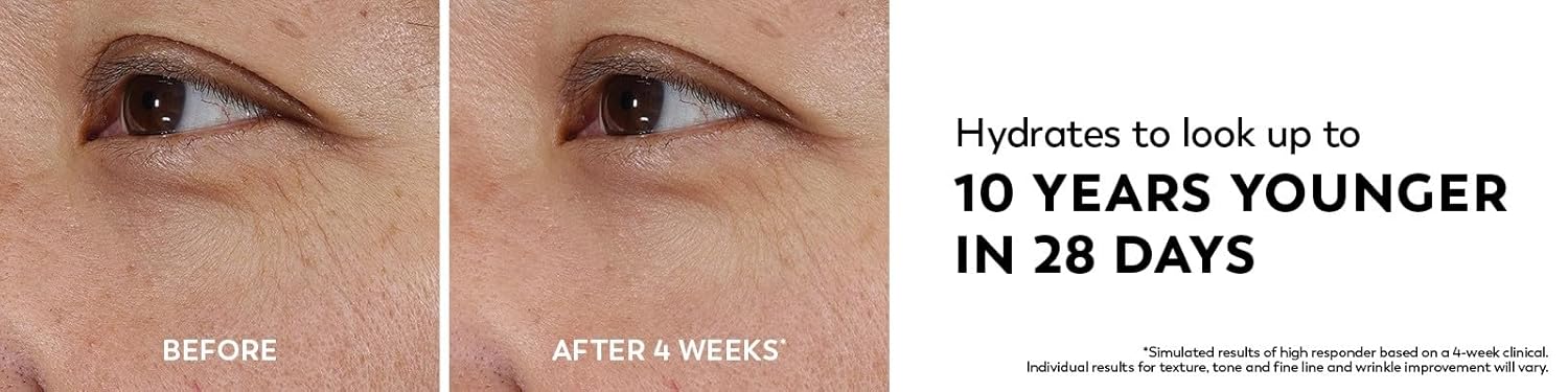 Before and after comparison of eye area with text claiming hydration benefits.
