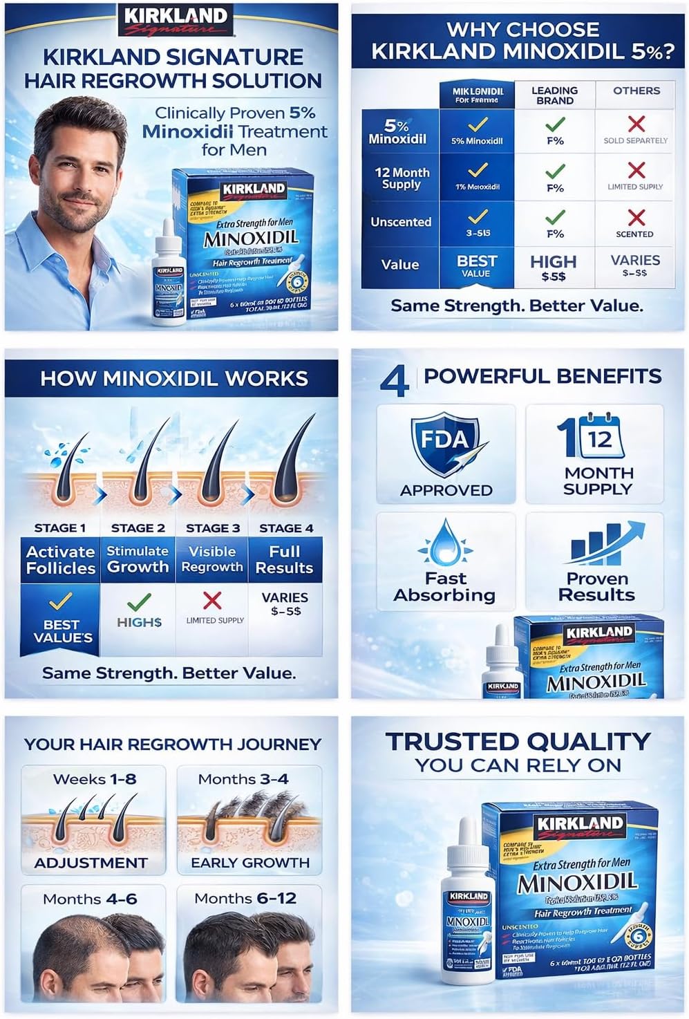Kirkland Minoxidil hair regrowth solution advertisement with product packaging, usage stages, and benefits.