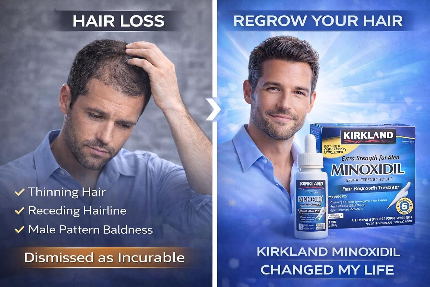 Advertisement for Kirkland Minoxidil hair regrowth product showing a man with thinning hair and text about hair loss and regrowth.