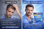 Advertisement for Kirkland Minoxidil showing a man with thinning hair and the product packaging.