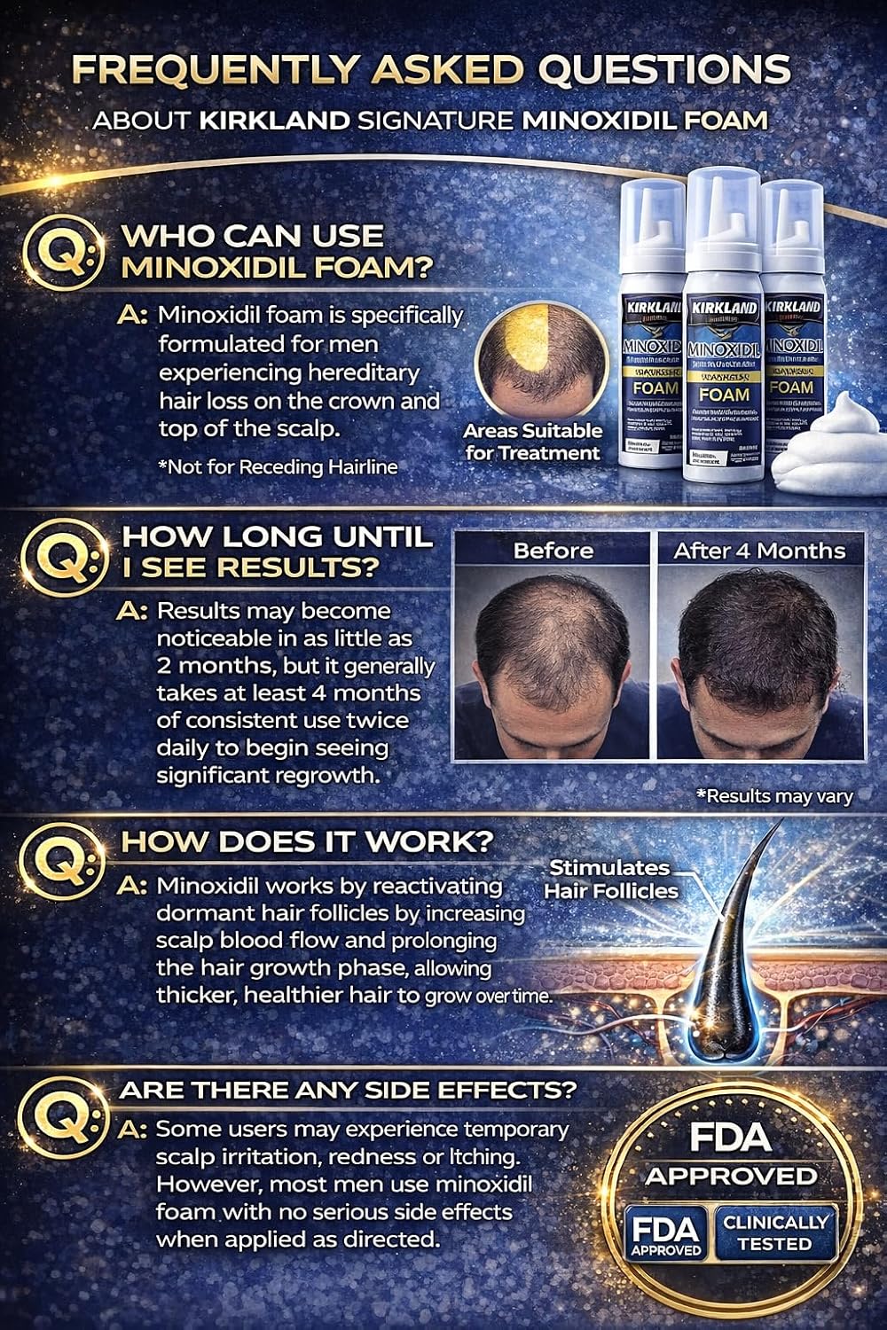 Kirkland Signature Hair Regrowth Treatment Minoxidil Foam for Men, 2.11 oz, 6 Count (6 Month Supply)
