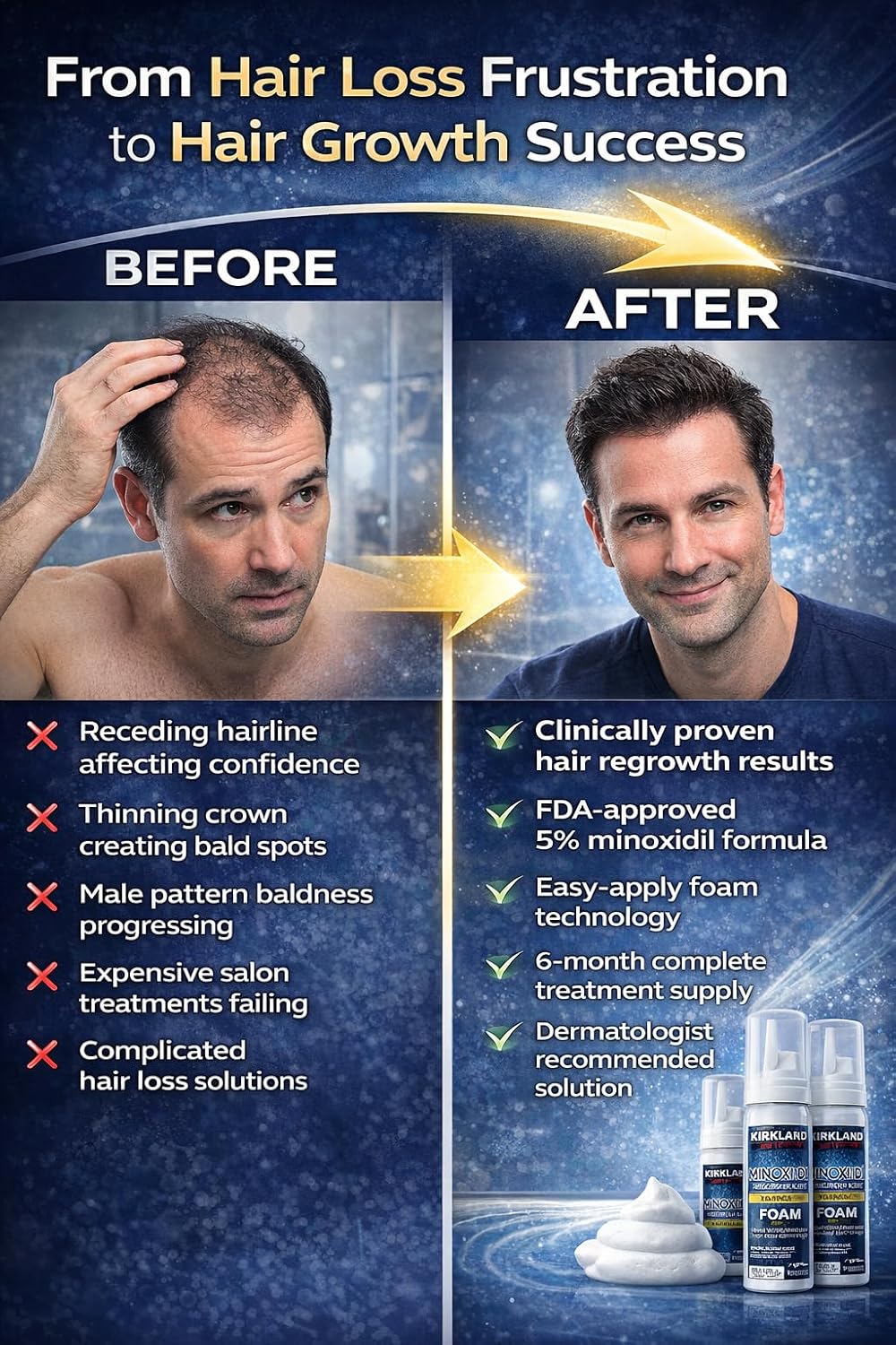 Kirkland Signature Hair Regrowth Treatment Minoxidil Foam for Men, 2.11 oz, 6 Count (6 Month Supply)