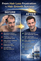 Kirkland Signature Hair Regrowth Treatment Minoxidil Foam for Men, 2.11 oz, 6 Count (6 Month Supply)