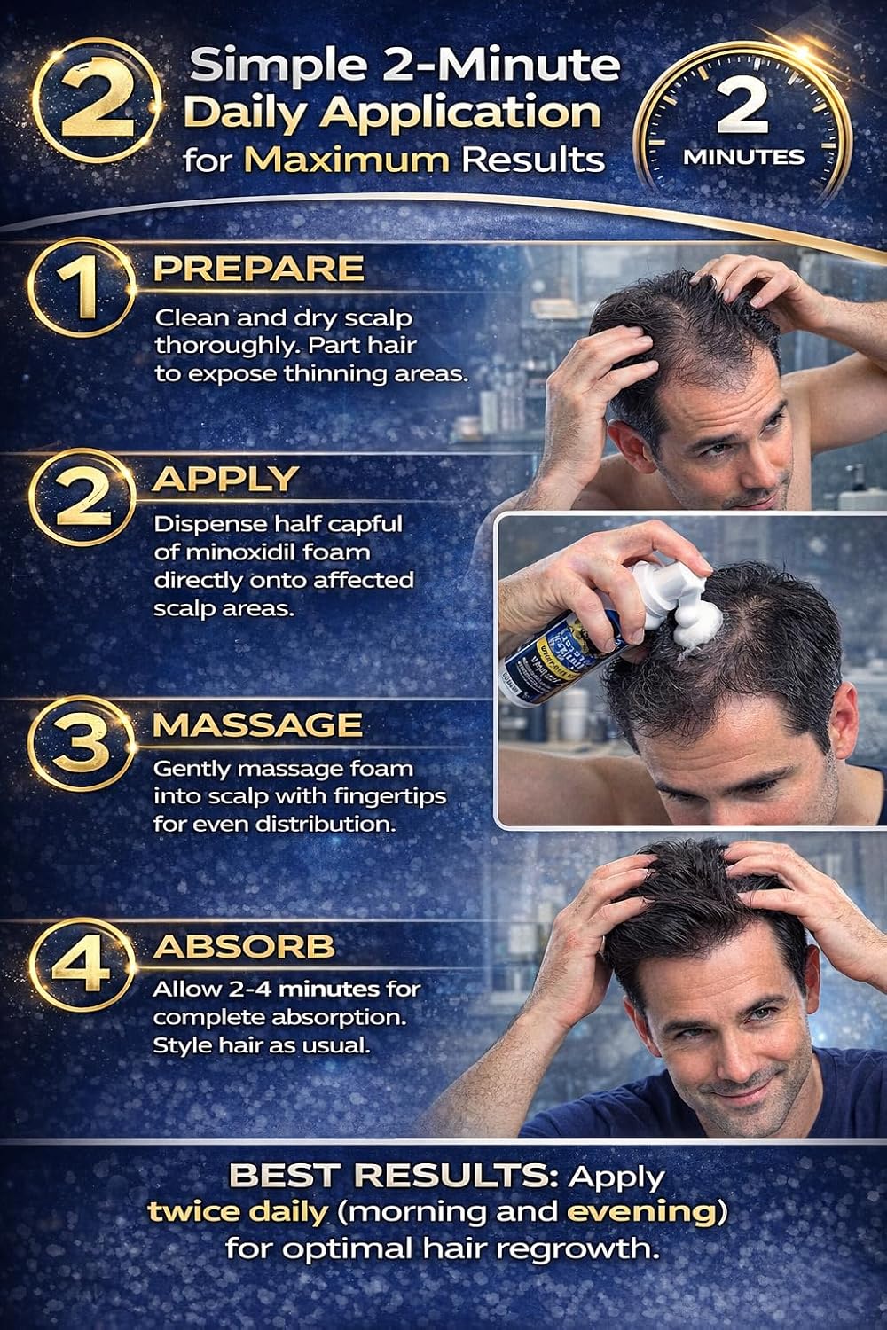 Kirkland Signature Hair Regrowth Treatment Minoxidil Foam for Men, 2.11 oz, 6 Count (6 Month Supply)